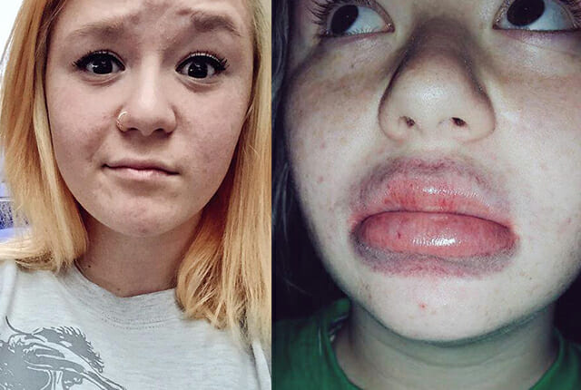 beauty fails