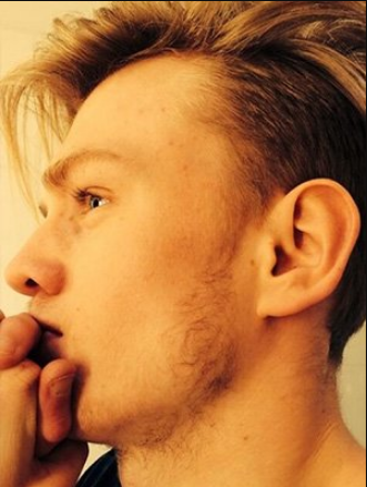 Justin Bieber Facial Hair