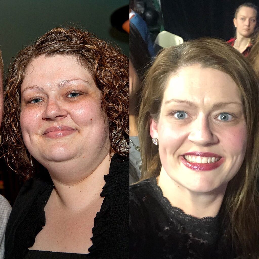 Amanda Wood's weight loss transformation